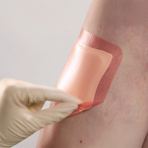 Allevyn Adhesive Yara Örtüleri